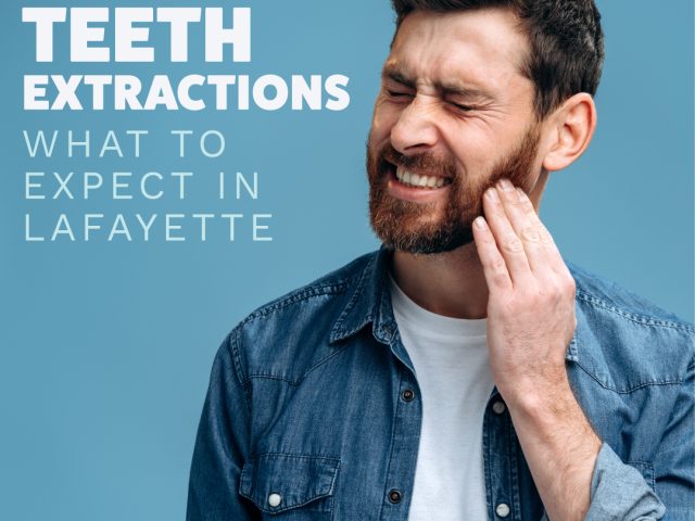 Wisdom Teeth Extraction in Lafayette: What to Expect (featured image)